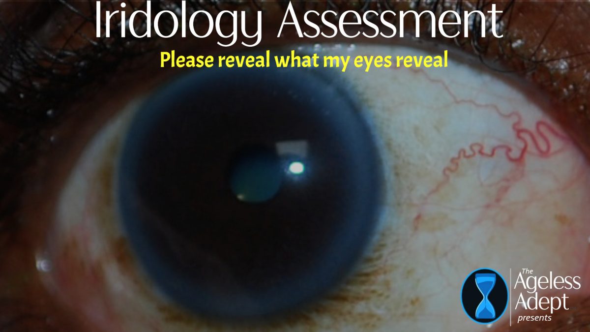 Please Provide an Iridology Assessment of My Eyes