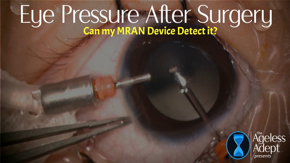 Monitoring Eye Health After Detached Retina Surgery