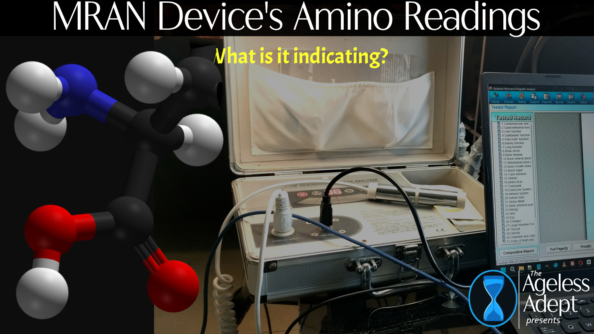 Mran MRAN Amino Acids Levels Explained. What Do They Really Represent? - The ...