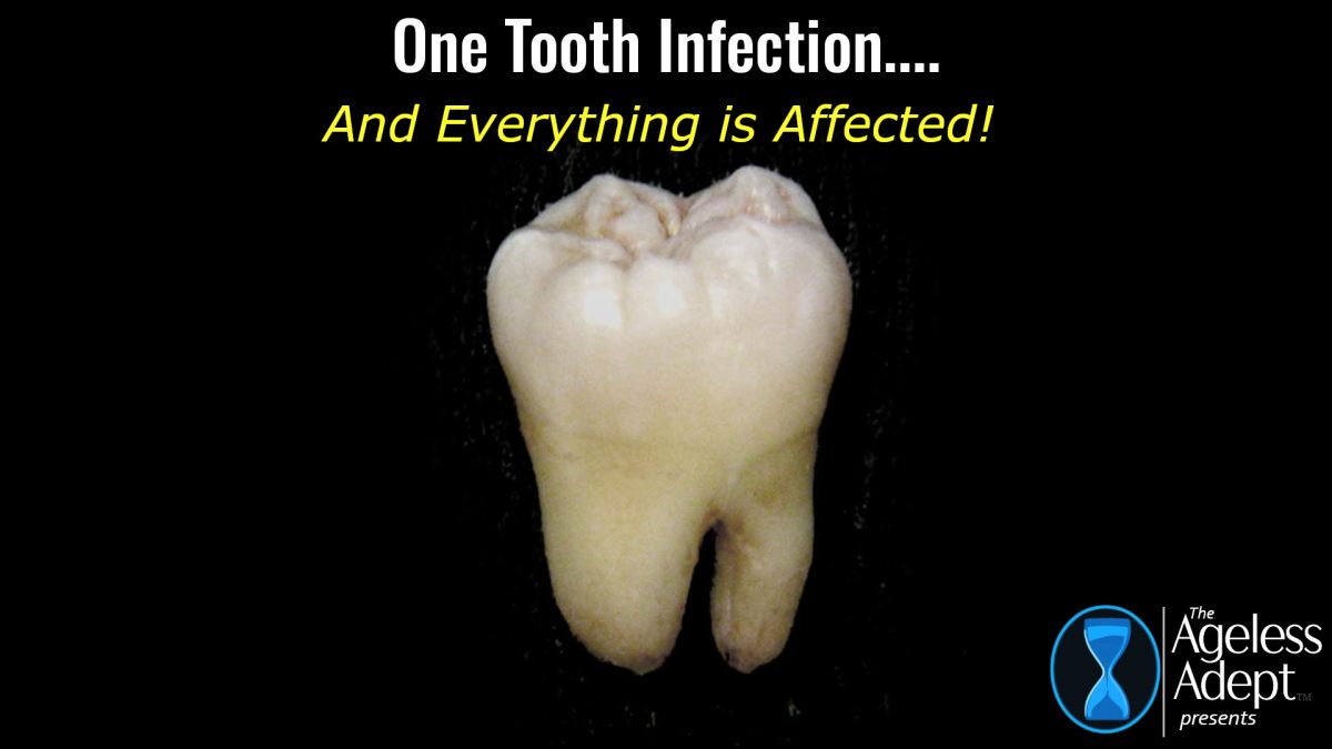 Tooth Infection = Lower Testosterone???? Plus a Whole Lot More!